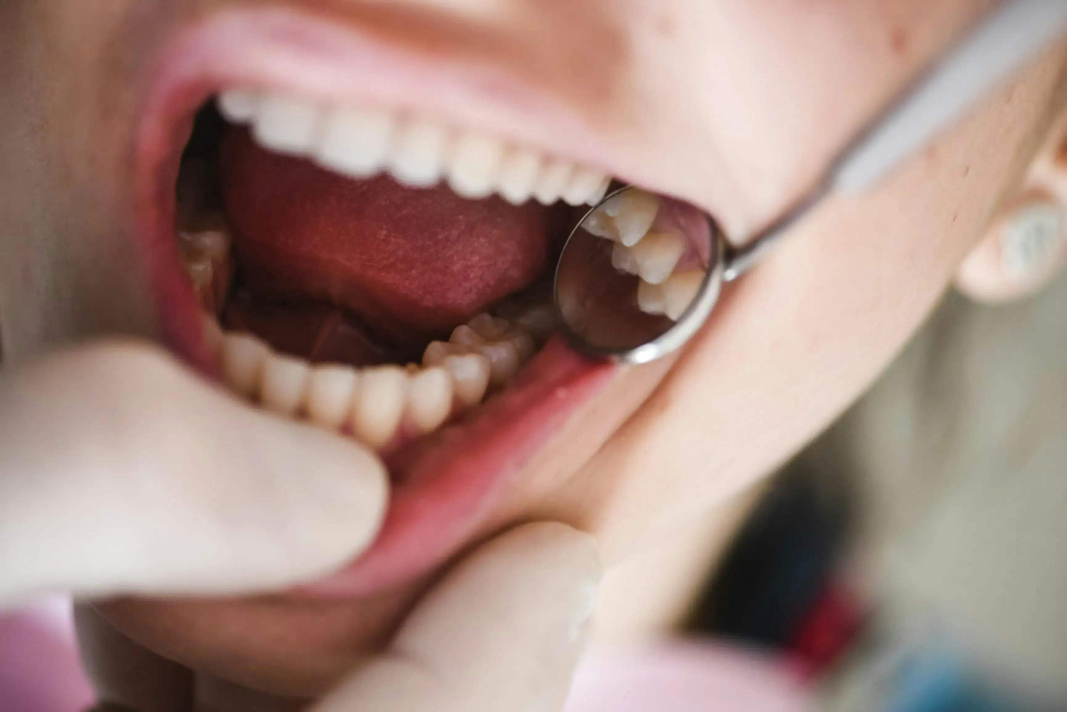The importance of regular dental check-ups